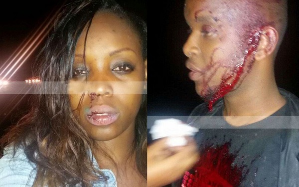 The accident left her and an unidentified man injured. Photo: Instagram