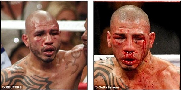 Cotto lost on points to Mayweather and looked in better shape than the bloodied mess he was post-Pacquaio