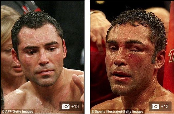 De La Hoya looks in better shape after fighting Mayweather (left) compared to his battered and bruised face after his defeat to Pacquiao