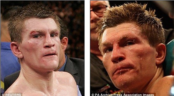 Hatton was stopped by both Mayweather (left) and Pacquiao (right) and looked more dazed after his brutal second round knock out by the Filipino