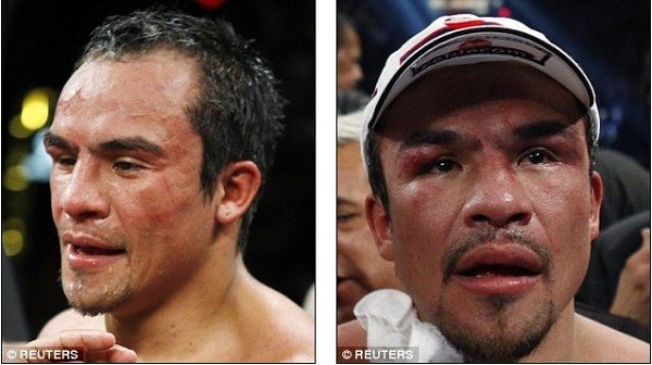 Marquez was beaten on points by Mayweather and had four epic fights with Pacquiao where he lost two, drew one and won one