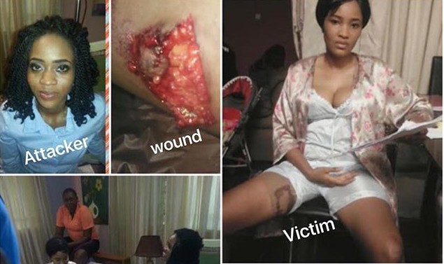 Nollywood actress who was bitten