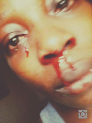 Joju accuses her younger brother of assault. Photo:Facebook