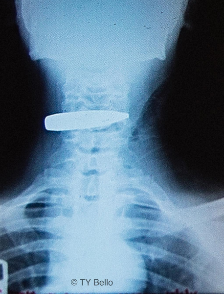 Screen Shot 2016-07-11 at 11.08.08 PM