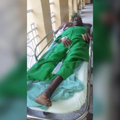 Tunde Alabi after leg amputation