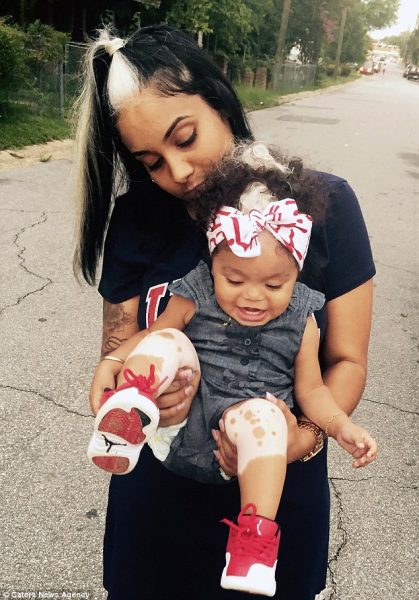 Mother and child with white streak of hair