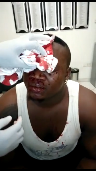 Injured Iliyasu