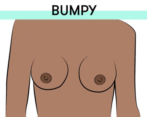 bumpy nipples