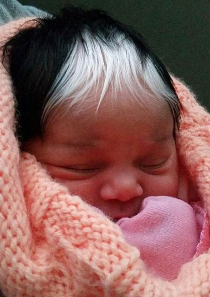 Brianna had hoped her baby would be born with the rare condition