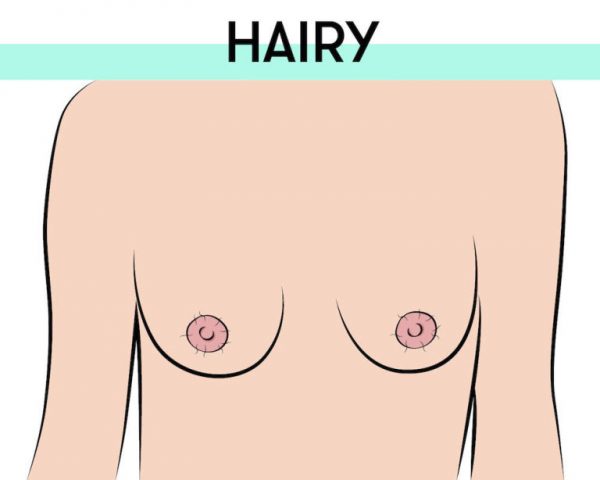 hairy nipples