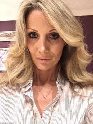 Aj before the surgery