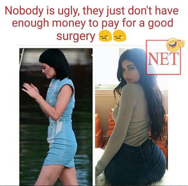 Kylie_before and now