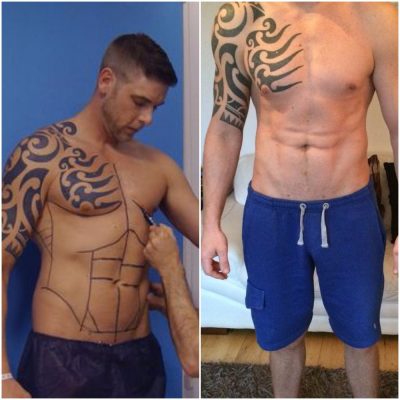 Lee Coupland before and after his surgery